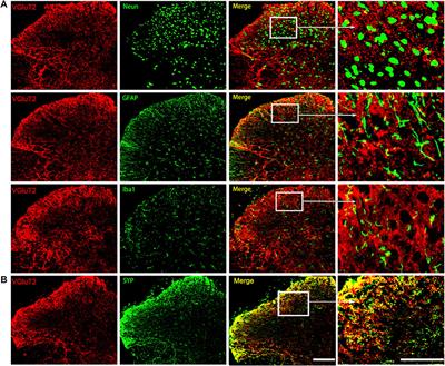 Dysregulation of Vesicular Glutamate Transporter VGluT2 via BDNF/TrkB Pathway Contributes to Morphine Tolerance in Mice